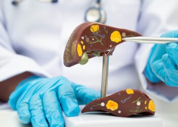 Fatty Liver Now Affects 1 in 3 Adults Without Warning Signs