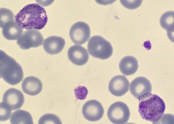 Brain-eating amoeba causes tragic death of woman in Texas while rinsing her nose