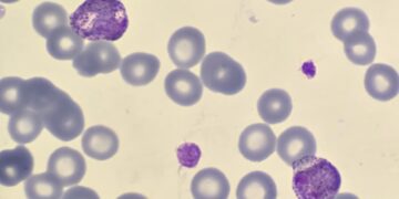 Brain-eating amoeba causes tragic death of woman in Texas while rinsing her nose