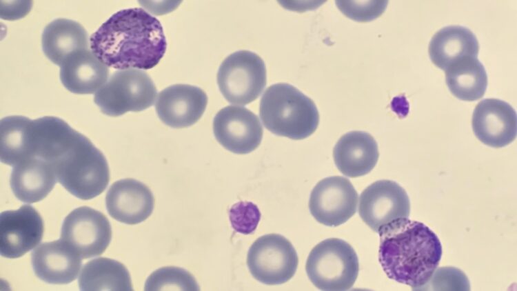 Brain-eating amoeba causes tragic death of woman in Texas while rinsing her nose