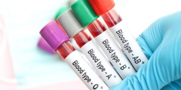 Science in shock - new blood group found in Guadeloupe that does not match any other human being