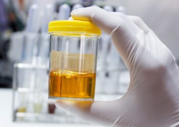 Confirmed - this is how they're recycling electric car batteries using urine... and it works better than you'd imagine