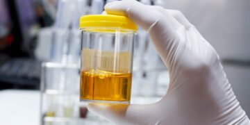 Confirmed - this is how they're recycling electric car batteries using urine... and it works better than you'd imagine