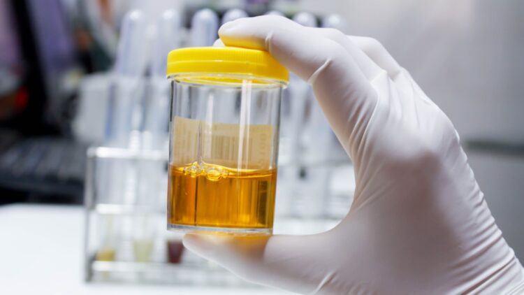 Confirmed - this is how they're recycling electric car batteries using urine... and it works better than you'd imagine