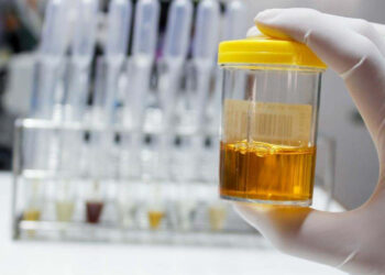 It's official—scientists in Sweden and India have managed to recycle electric car batteries using urine and vinegar! — and recover up to 97% of the cobalt