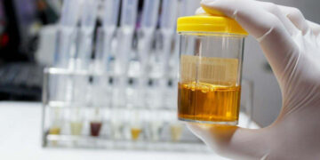 It's official—scientists in Sweden and India have managed to recycle electric car batteries using urine and vinegar! — and recover up to 97% of the cobalt