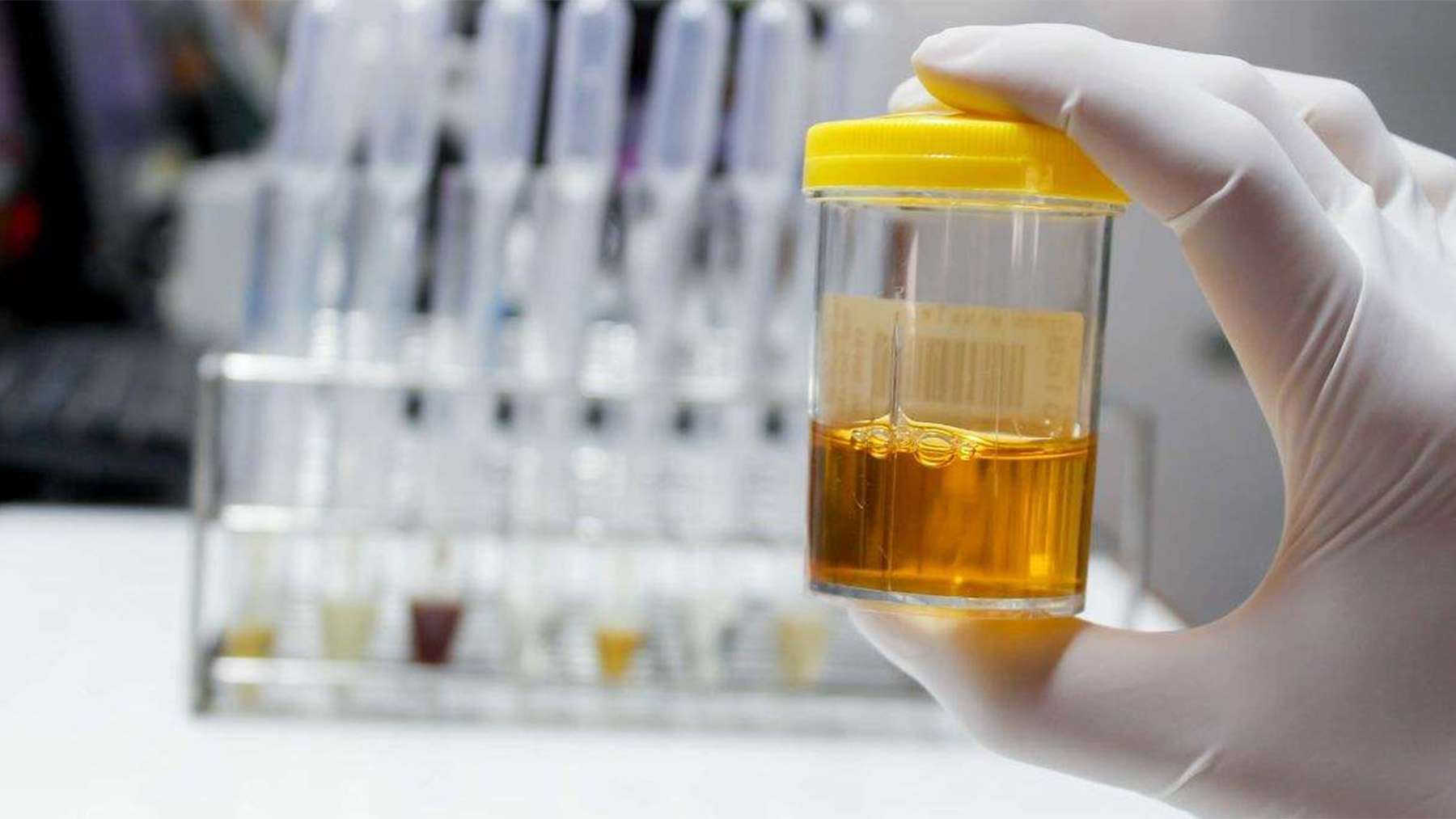 It's official—scientists in Sweden and India have managed to recycle electric car batteries using urine and vinegar! — and recover up to 97% of the cobalt