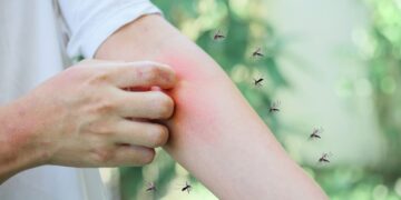 Ni zumbidos ni picaduras: esta planta repele los mosquitos