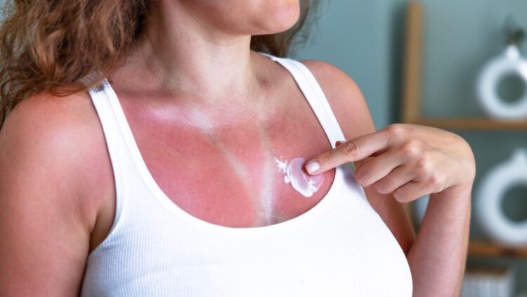 La advertencia de un especialista: si después de tomar el sol pasa esto, debes acudir al médico 1 Si después de tomar el sol pasa esto, debes acudir al médico